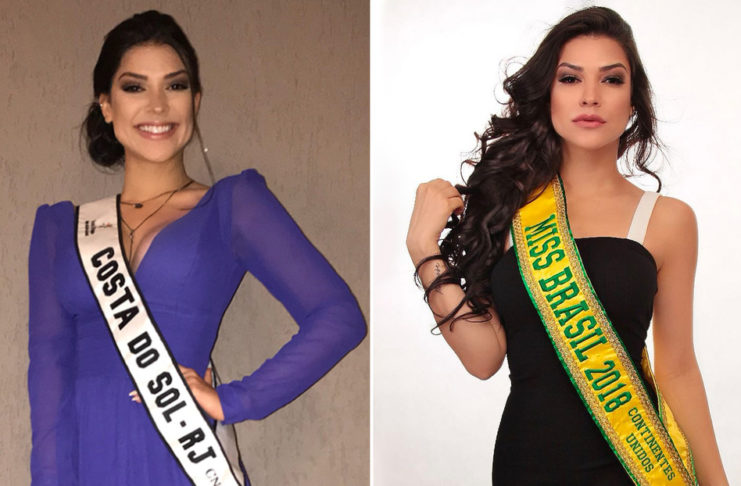 Exreina de belleza brasileña tras una cirugía de amígdalas