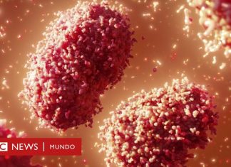 Se registra la primera muerte por viruela del mono en EE.UU