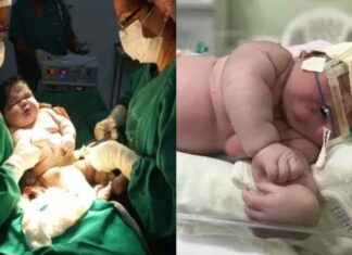Nace un “bebé gigante” de 7,3 kg en Brasil