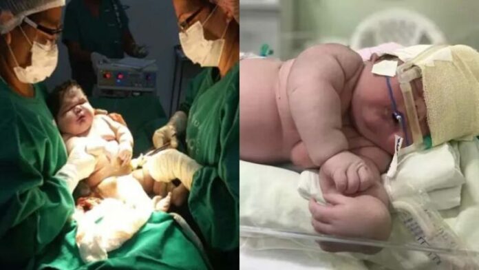 Nace un “bebé gigante” de 7,3 kg en Brasil