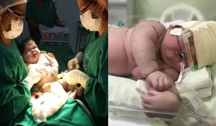 Nace un “bebé gigante” de 7,3 kg en Brasil