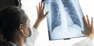 El cáncer es un reto de la salud pública mundial con tasas de prevalencia, incidencia y mortalidad en crecimiento que desafían a los estados, sistemas de salud y a la ciencia.