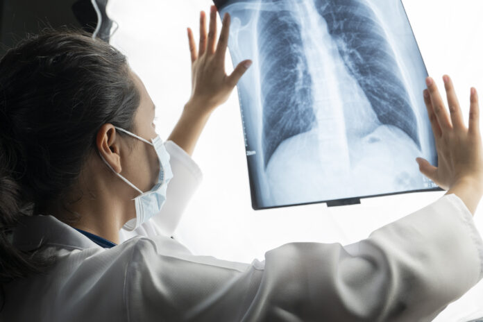 El cáncer es un reto de la salud pública mundial con tasas de prevalencia, incidencia y mortalidad en crecimiento que desafían a los estados, sistemas de salud y a la ciencia.