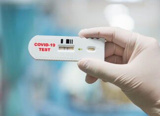 Aunque esta semana el país notificó la circulación de la nueva variante JN.I del Covid-19, las notificaciones de nuevos casos positivos del virus registraron disminución con relación a la semana anterior.
