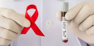 Más de 78,000 personas en el país viven con VIH