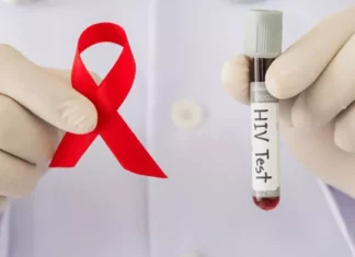 Más de 78,000 personas en el país viven con VIH