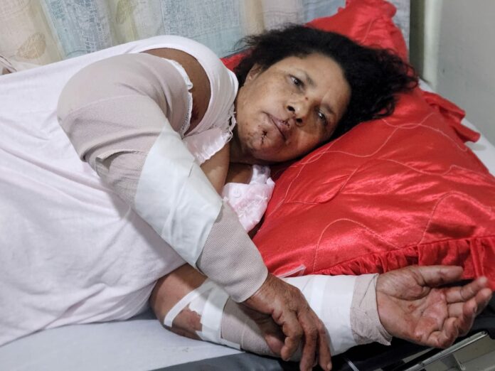 Una mujer de 54 años de edad resultó herida este martes al ser atacada por dos perros pitbull en el barrio Nuevo La Herradura, al suroeste de la provincia Santiago.