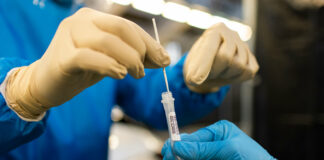 Los casos fueron detectados en un total de 2,295 muestras de laboratorio procesadas, de las cuales 1,140 fueron a pacientes de primera vez y el resto eran muestras de seguimiento.