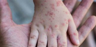 La alerta epidemiológica a nivel global, motivó a las autoridades establecer medidas de prevención tanto en las zonas fronterizas, así como, con los cluster turísticos.