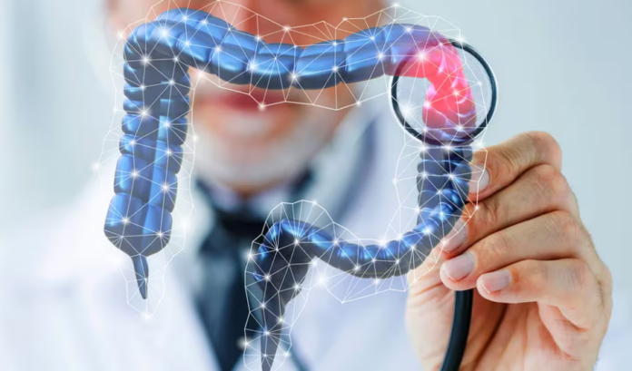 ¿El café puede ser un aliado ante el cáncer de colon?