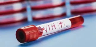 Transmisión de VIH vía madre-hijo afecta desarrollo cognitivo