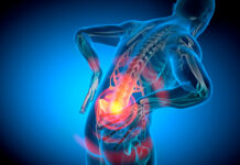 A más estrés, más dolor de espalda