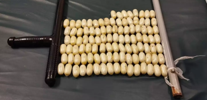Arrestan extranjero con 104 bolsitas de presunta cocaína en el estómago