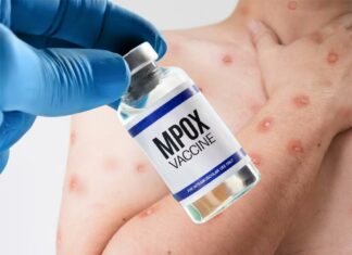 España vigilante sin excesos de alarmas por mpox