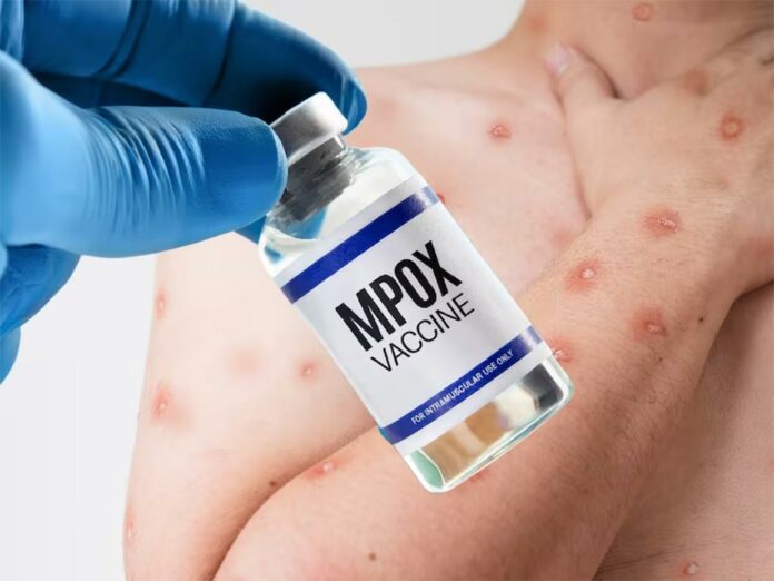 Venezuela anuncia plan epidemiológico ante propagación de mpox