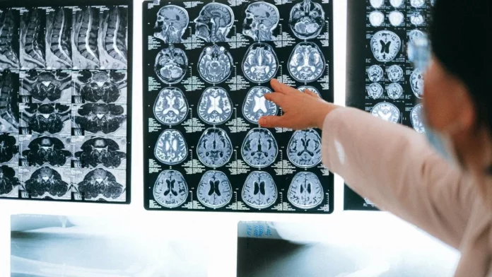 A los 57 años comienza el envejecimiento de nuestro cerebro