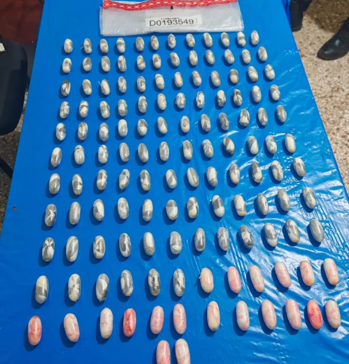 Atrapan nigeriano con 134 bolsitas de cocaína en el estómago