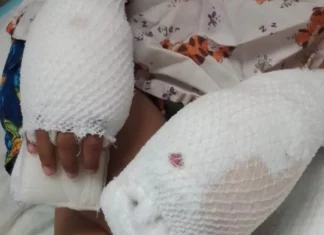 Aplazan medida de coerción en contra de madre acusada de quemarle las manos a su hijo