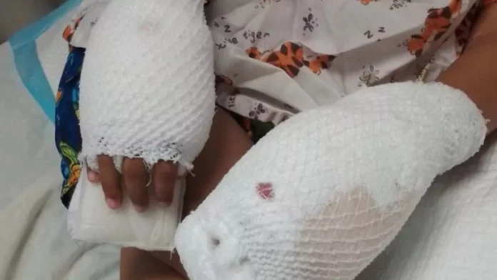 Aplazan medida de coerción en contra de madre acusada de quemarle las manos a su hijo