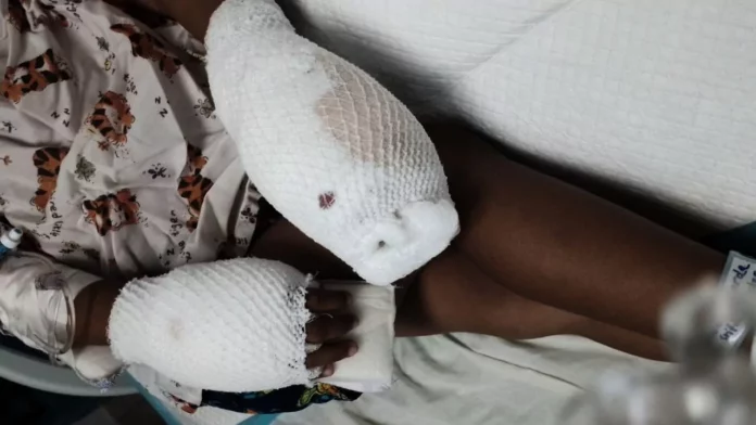 Tres meses de prisión preventiva a mujer acusada de quemarle las manos a su hijo