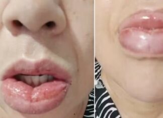 Dejarán de fabricar una conocida pasta dental después de miles de denuncias por reacciones adversas