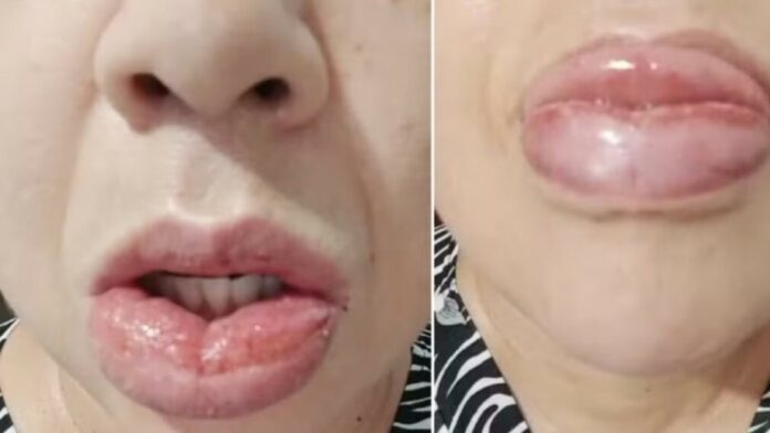 Dejarán de fabricar una conocida pasta dental después de miles de denuncias por reacciones adversas