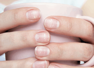 Qué significan las manchas blancas en las uñas