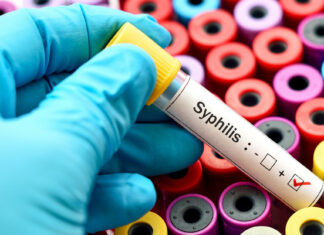 Un país europeo registra récord de infecciones por sífilis