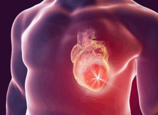 Identifican una proteína que agrava el riesgo de muerte súbita después de un infarto