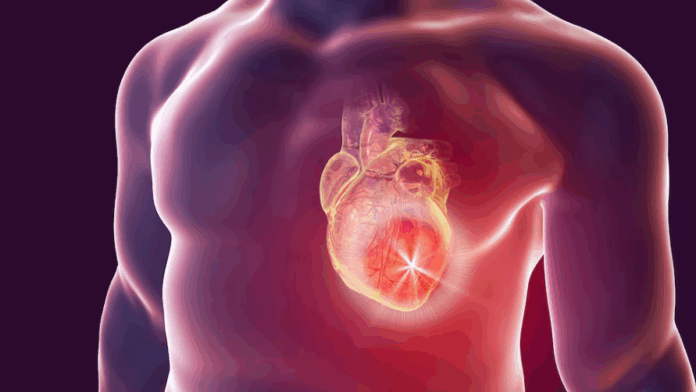 Identifican una proteína que agrava el riesgo de muerte súbita después de un infarto