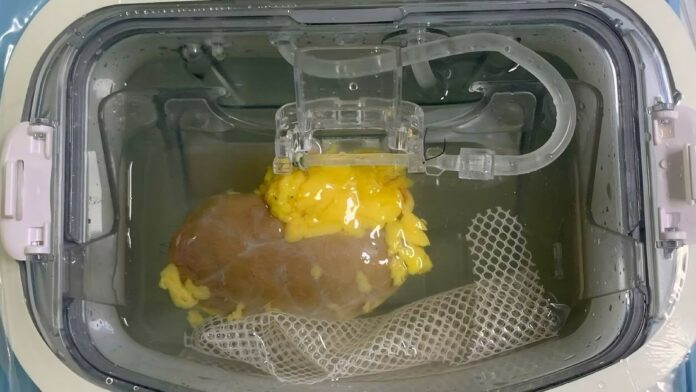 Científicos crean un riñón universal compatible con cualquier paciente
