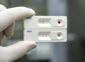 Rusia crea la primera prueba rápida del mundo para diagnosticar hepatitis C