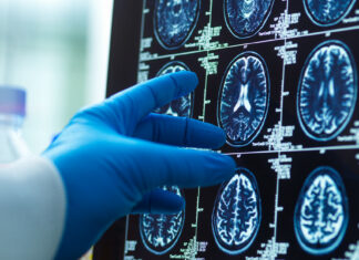 Los consejos de la ciencia para tener un cerebro hasta 8 años más joven
