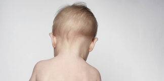 Bebé de 8 meses resulta herido en la cabeza tras ser impactado por piedra