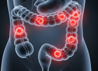 Una vacuna experimental logró activar las defensas contra el cáncer de colon hereditario