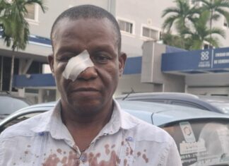 Profesor es agredido por estudiantes en liceo del DN