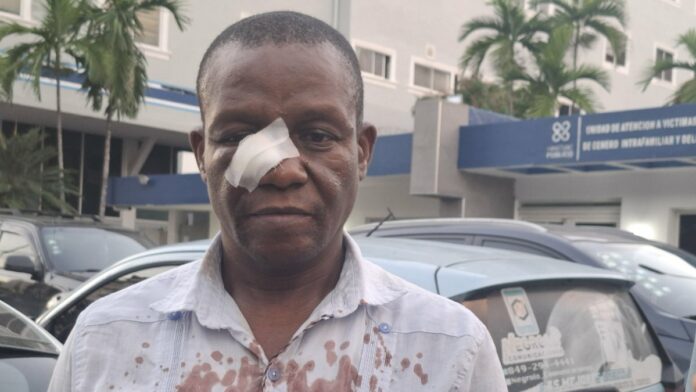 Profesor es agredido por estudiantes en liceo del DN