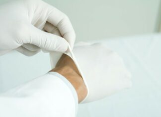 Se explotó un grano en la cara y tuvo que ser hospitalizada