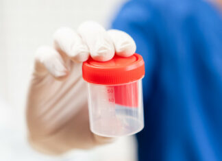 Detectan el primer caso en el mundo de una rara enfermedad transmitida por donación de esperma