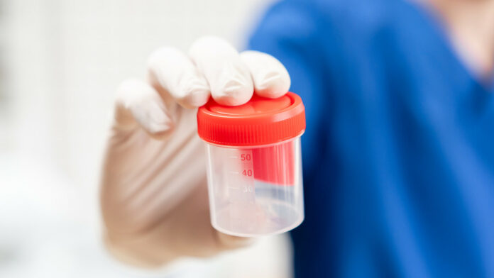 Detectan el primer caso en el mundo de una rara enfermedad transmitida por donación de esperma