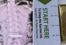 Hospitalizan a una niña de 5 años tras tragarse un lingote de oro